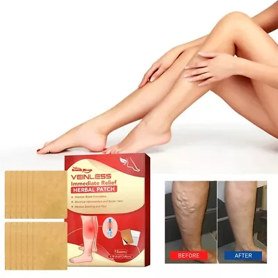 Veinless Immediate Relief Herbal Patch Varicose Veins Care Patch 12Pcs/Pack • $7.79