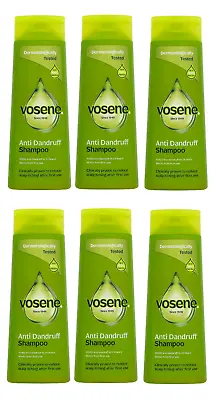 VOSENE MEDICATED ORIGINAL DANDRUFF SHAMPOO ALL HAIR TYPES 300ml • £16.99