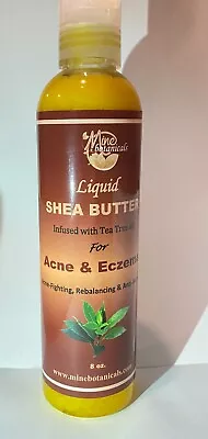 Liquid Shea Butter For Acne & Eczema 8 Oz • $10.75