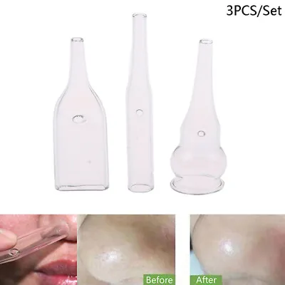 3Pcs/Set Blackhead Removal Glass Pipe Face Pore Cleanser Vacuum Extractor Tube • $5.68