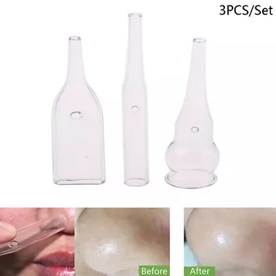 3Pcs/Set Blackhead Removal Glass Pipes Face Pore Cleanser Vacuum Extractor Tube • $7.01