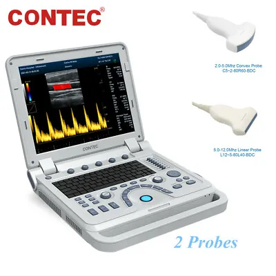£4040 • Buy CMS1700A Portable Color Doppler Ultrasound Scanner Machine Convex+Linear 2 Probe