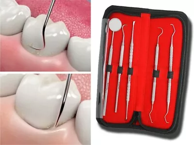 £5.98 • Buy Dental Teeth Whitening Kit Dentist Tooth Plaque Calculus Tartar Remover Tools