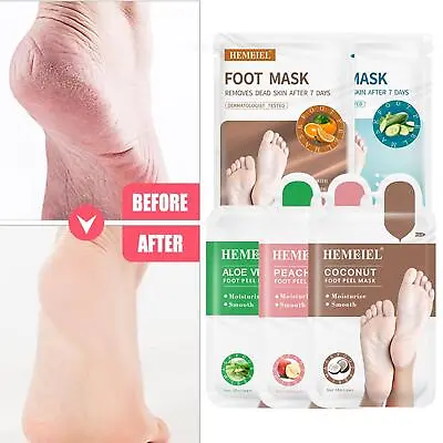 Exfoliating Foot Mask Peel Off Foot Sock Soft Baby Dead Callus Skin Feet L7S0 • £3.13