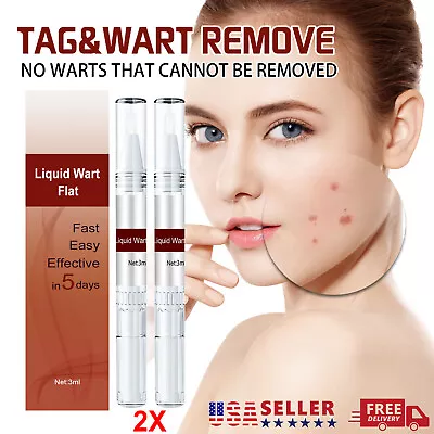 2X Common And Plantar Moles-Off Wartsoff Remover WipeOff Tags&Moles Remover US • $12.95