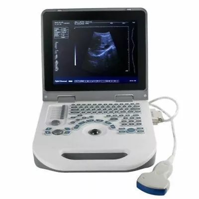 12  Portable Laptop Full Digital Ultrasound Scanner Machine With Convex Probe 3D • $1399