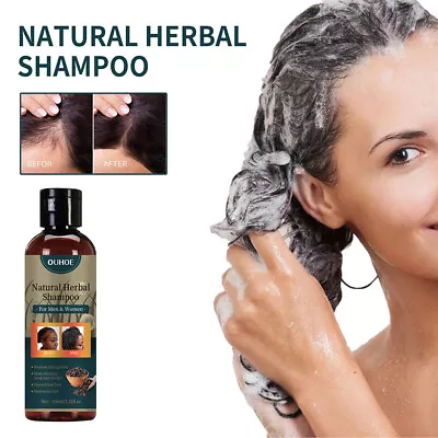 Thicken Hair Shampoo For Women Men Anti-Dropping Shampoo Hair Care Drop Shipping • £5.87