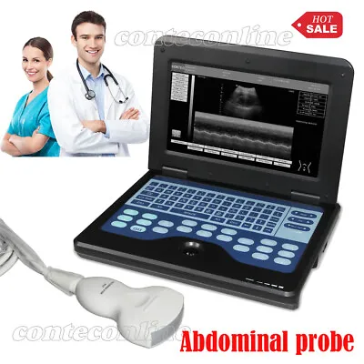 New Portable Laptop Machine Digital Ultrasound Scanner With Convex Probe • £1112