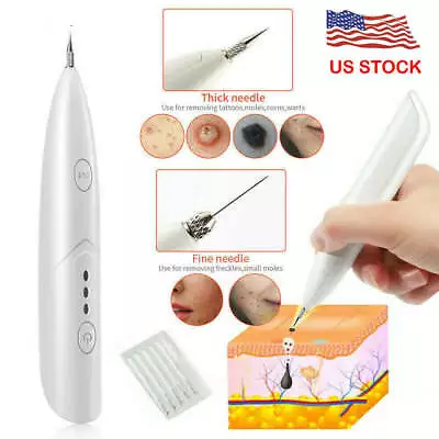 Mini Laser Freckle Skin Mole Dark Spot Remover • $20.98