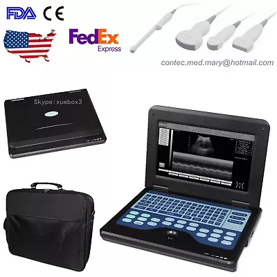 NEW Portable Digital Ultrasound Scanner Machine Diagnostic System 4 ProbeFDA • $400