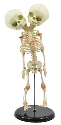 Infant Fetus Skeleton Model Mini Size - Twin Conjoined Skull - Eisco Labs • $36.69