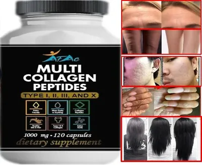 COLLAGEN Hydrolyzed 100% PURE BONES Health HAIR SKIN And NAILS 120 • $11.50