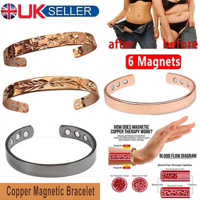 Mens Ladies Magnetic Health Bracelet Copper Healing Bangle Arthritis Pain Relief • £5.29