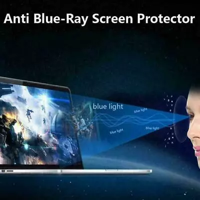 1pc 15.6  Monitor Laptop LCD Clear Screen Guard LED L0Z0 B0J7 Film U7Y6 • £1.82