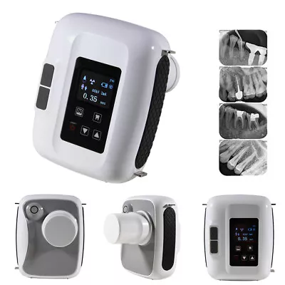 Portable Mobile Dental Digital Imaging System X-Ray Machine • $667