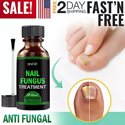 Anti Fungal Treatment Extra Strength Toenail Fungus Fungi Xs Nail Athlete's Foot • $8.99