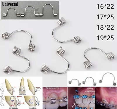 Dental Orthodontic Torquing Torque Spring Arch Wire For Single Anterior Teeth • $243.21