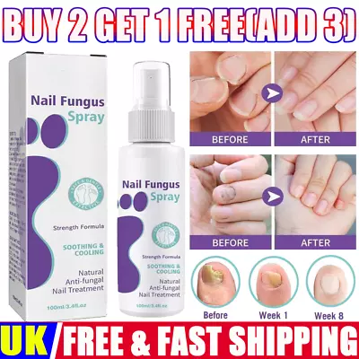 100ML Medinail Fungus Repair Spray For FootNail Soft Nail Fungus Treatment++ • £7.27