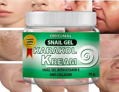 Karakol Cream Snail Cream Gel  Skincare Snail Caracol Gel Face Hands Dark Spots • $12.98