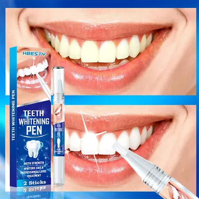 Teeth Whitening Gel Pen Strong White Tooth Whitener Remover Delicate Stains. • $10.54