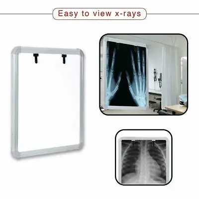 LED X-Ray View Box With Automatic Film Activation (Size-14X17 Inch)Fast Shipping • $75.61