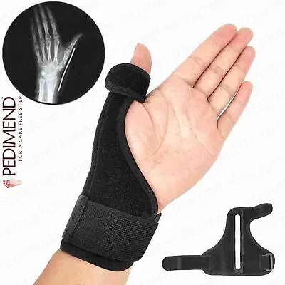 PEDIMEND™ 1x Thumb Splint Support Brace Spica Left Right De Quervain's Arthritis • £7.99