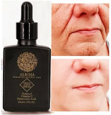 £6.99 • Buy 30ml Vitamin C Face Serum + Hyaluronic Acid + Retinol Anti Ageing Aging Wrinkle 