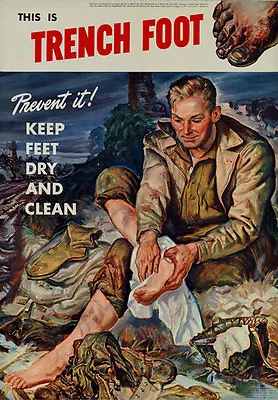 2W48 Vintage WWII This Is Trench Foot Wartime Health War Poster WW2 A4 • £2.93