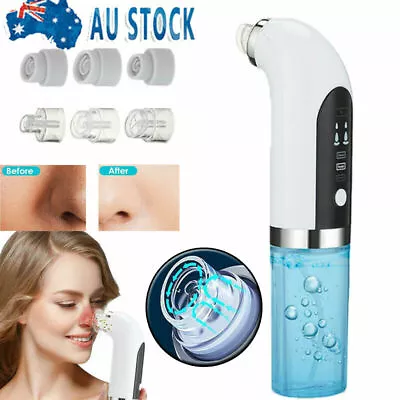 $27.99 • Buy Electric Blackhead Remover Vacuum Acne Pore Cleaner Facial Suction Cleaning Set