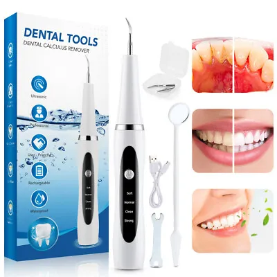 £14.95 • Buy Electric Sonic Dental Scaler Tooth Cleaner Teeth Calculus Plaque Stains Remover~
