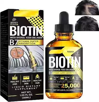 Biotin Hair Growth Serum For Men. Hair Loss Receding Hairline Going Bald Balding • £19.99