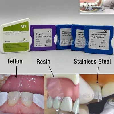 Dental Teflon/Resin/Metal Matrix Bands Teeth Restoration Matrix Strips Retainer • $27.99