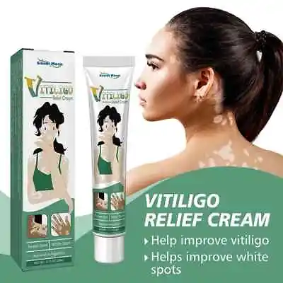 Vitiligo Cream Effective Elimination Of Vitiligo All Over The Body • $26.95