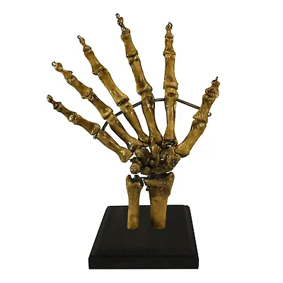 Vintage BIZARRE! 6 Finger Medical Specimen Skeleton Hand Oddity Curiosity Gaff • $79