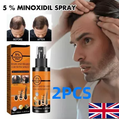 £7.98 • Buy 2X 5 % Minoxidil Hair Growth Spray For Men Women 100ml Hair Regrowth Treatment