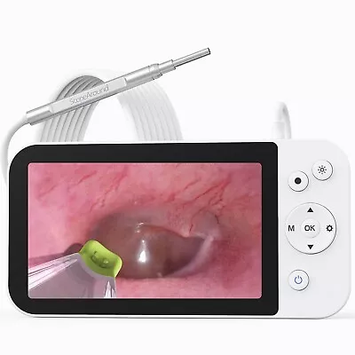 3.9mm Otoscope Camera Ear Wax Removal Inspection Camera 1080P HD Video Endoscope • $89.99