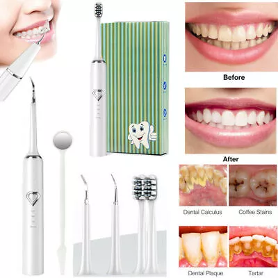 Electric Teeth Cleaning Kit Ultrasonic Tooth Cleaner Dental Scaler Stain Remover • $15.99