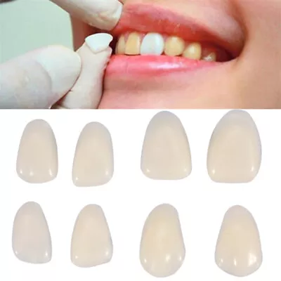 Ultra Thin Whitening Veneers Denture Patch Fake Teeth Gap Cover Temporary Repair • £3.83