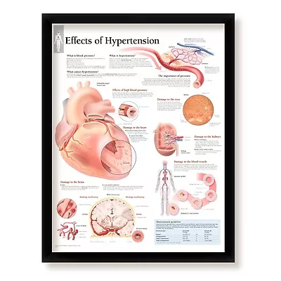 Effects Of Hypertension Medical Poster Diagram Doctors Office School Classroom • $65.99