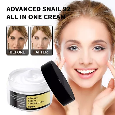 Advanced Snail 92 All In One Cream 100ml Tighten Facial Skin Reduce Wrinkles • $9.65