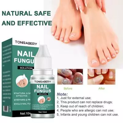 Anti Fungal Nail Treatment Fungu Nail Finger Toe Fungus Onychomycosis Deal • $1.80