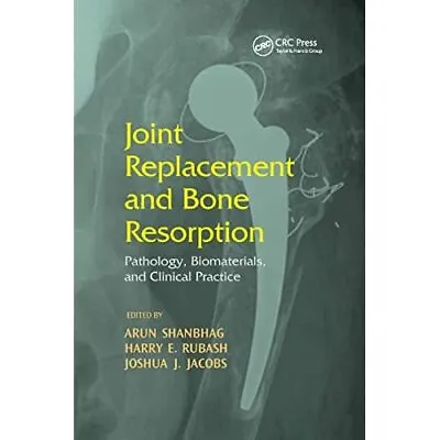 £59.37 • Buy Joint Replacement And Bone Resorption: Pathology, Bioma - Paperback / Softback N