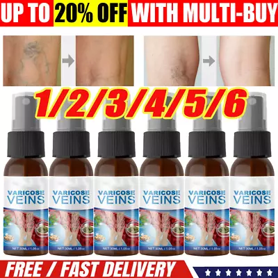 1-6X Veinhealing Varicose Veins Treatment Spray Legs Improve Blood Circulation • $7.99