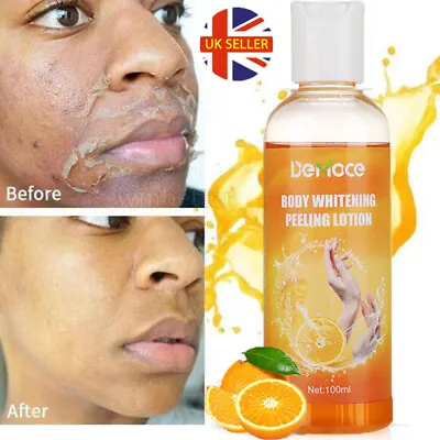 Orange Peeling Lotion Body Whitening Cream Lightening Brightening Skin Bleaching • £7.95