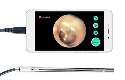 Hearscope Digital Otoscope FDA Cleared With Samsung Galaxy J5 Prime Smartphone • $249.99