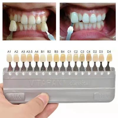 VITAPAN Classical Shade Guide Dental Materials A1-D4 16 Colors Teeth Whitening • $17.09