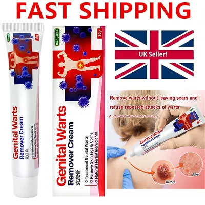 Genital Herpes Wart Remover Ointment Skin Tag Mole Acuminatum Treatment Cream UK • £4.69