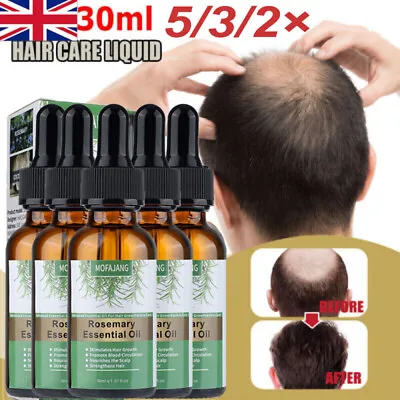 100% Natural Nourishes Hair 30ML Organic Rosemary Essential Oil For Hair Growth • £15.45