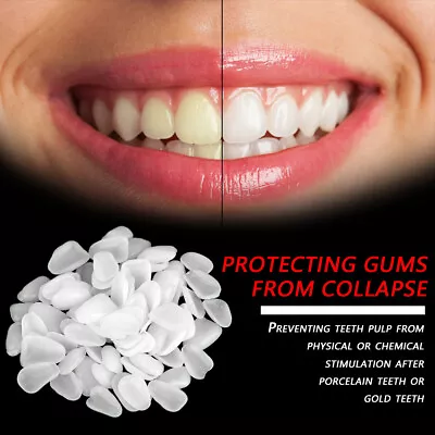 Dental Anterior Film Molar Teeth Temporary Crown Patch Porcelain Material Veneer • $10.30