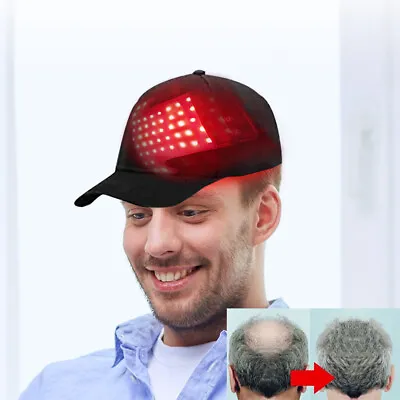 48 LED Light Therapy Hat Hair Regrowth Hair Growth Anti-Hair Loss Cap • $34.50